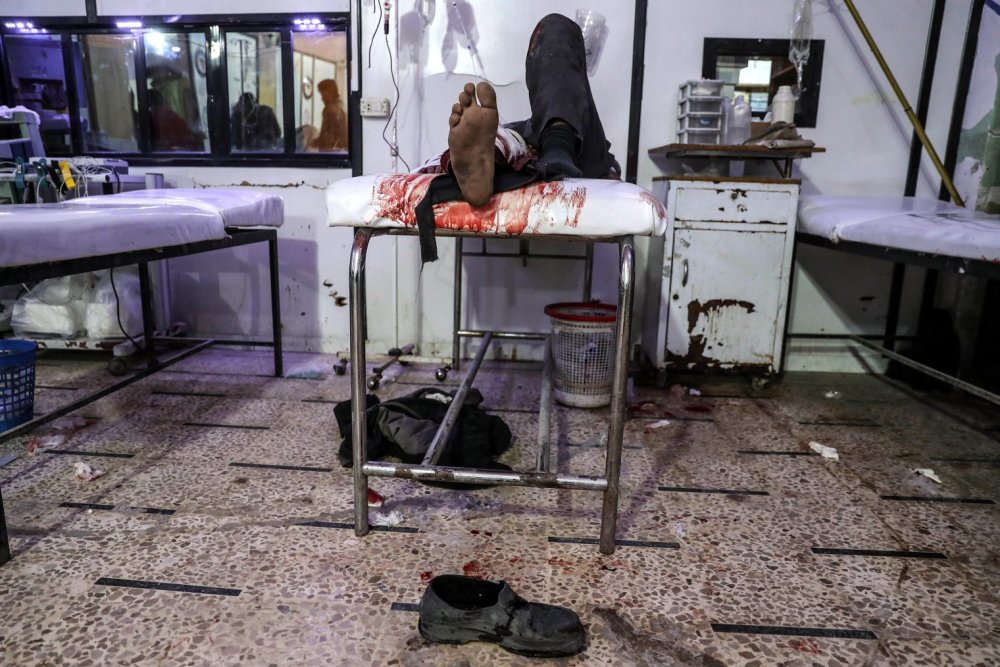 More than 100 civilians killed in Eastern al-Ghouta, Douma, Syria - 20 Feb 2018